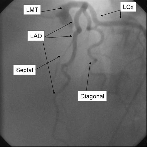 lao cranial images